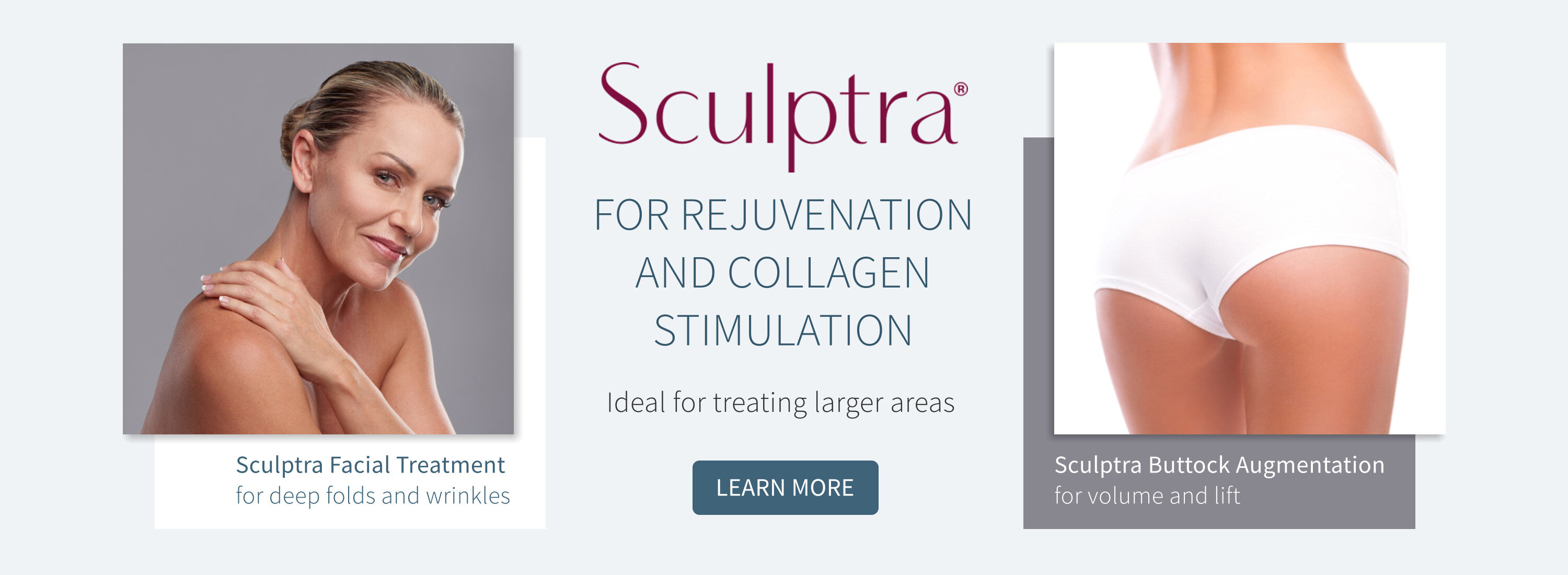 Sculptra
