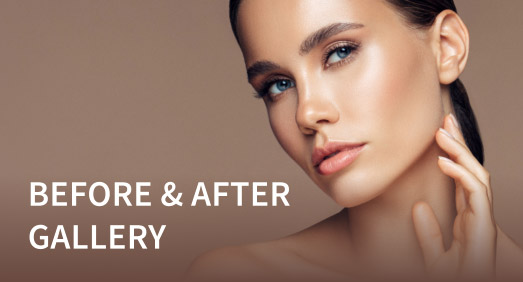 Before and After Plastic Surgery Photo Gallery