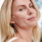Sculptra 101: The Collagen Revolution