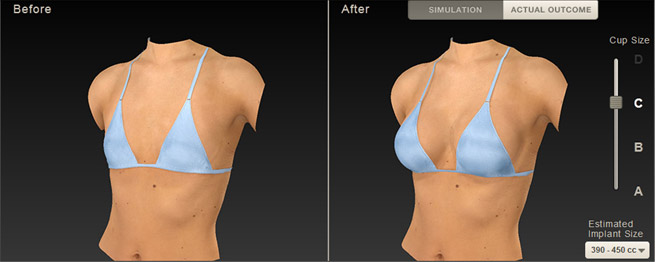 Vectra XT - Toronto Plastic Surgery